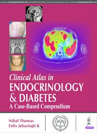 Clinical Atlas In ENDOCRINOLOGY & DIABETES – Department Of ...